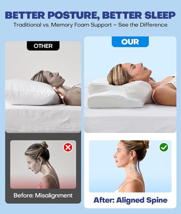 Sleep Doctor Approved Cervical Neck Pillow for Sleeping, Ergonomic Contour Side Sleeper Pillows for Adults, Cooling Orthopedic Pillow for Pain Relief Support, Memory Foam Pillows Back Stomach Sleepers
