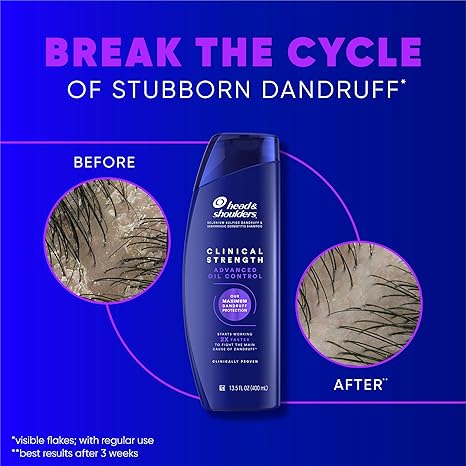 Head & Shoulders Anti-Dandruff Shampoo, Clinical Strength Intensive Itch Relief Twin Pack